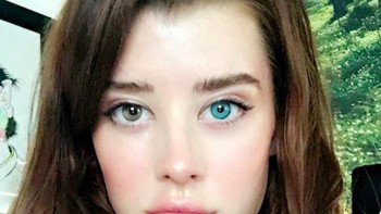 Namanya Sarah McDaniel, seorang model Amerika Serikat. Lihat matanya yang berbeda warna, kiri berwarna biru dan kanan warnanya kecoklatan. Foto: Instagram