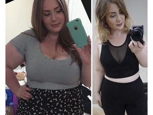 Foto: Transformasi Gadis Obesitas Turunkan Bobot Hingga 52 Kg
