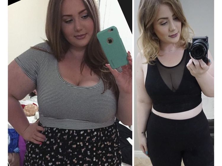 Foto: Transformasi Gadis Obesitas Turunkan Bobot Hingga 52 Kg