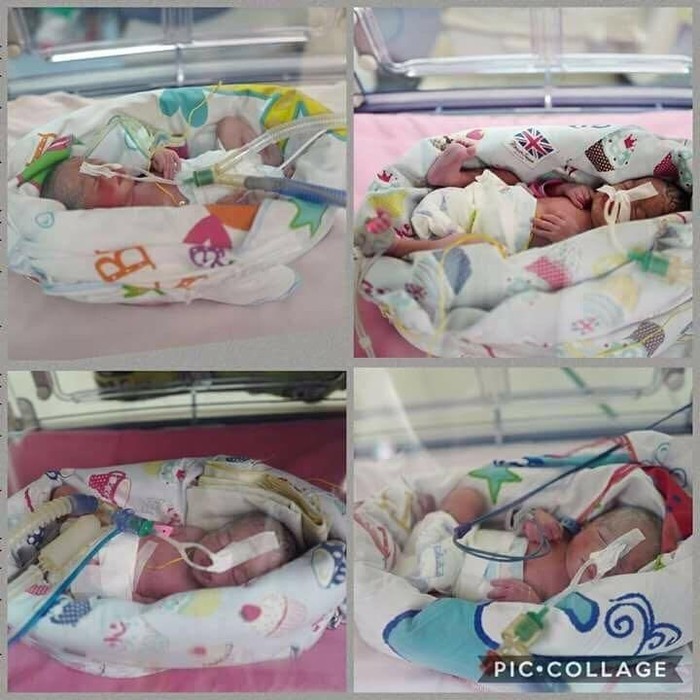 Ikut Program Inseminasi, Sefriani Lahirkan Bayi Kembar 4 di Palembang