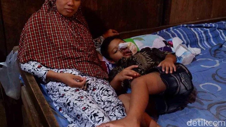 Ada Dugaan Benjolan yang Dialami Faiz Adalah Tumor Kulit Ada Dugaan Benjolan yang Dialami Faiz Adalah Tumor Kulit