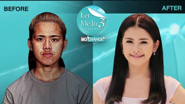 Pernah Dibully Mirip Penyihir, Tranformasi Wanita Oplas Ini Bikin Terpana