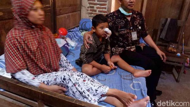 wajah faiz masih bengkak akibat tersengat lebah