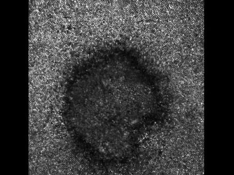 Nonton Gerhana Matahari dengan Kacamata Abal-abal, Ini Akibatnya