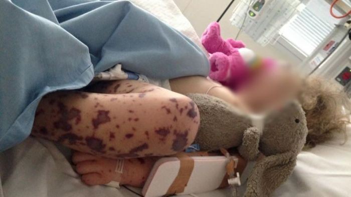 Terjadi Wabah, Pria Gay di Melbourne Diminta Suntik Vaksin Meningitis