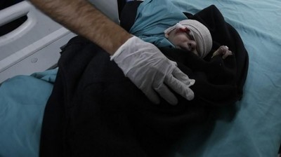 Foto: Balita Jadi Korban Serangan Balasan Israel untuk Roket dari Gaza