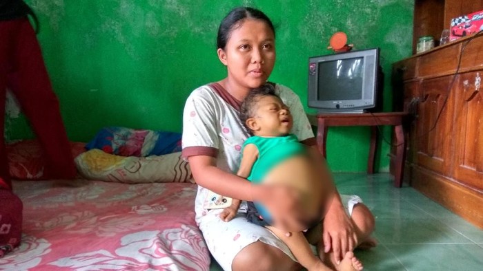 Pak Bupati, Bocah Sidoarjo Ini Butuh Uluran Tangan