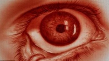 Ia juga menggunakan darah yang diambil dari seorang perawat. (Foto: Rev Mayers)