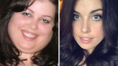 Drastis! Deretan Foto Selfie Sebelum dan Setelah Diet