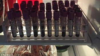 Botol darah miliknya yang disimpan di kulkas. Mayers menyadari hal yang ia lakukan dapat menghilangkan nyawanya. Ia pun merasakan efek sampingnya mulai dari pusing hingga kehilangan kesadaran. (Foto: Rev Mayers)