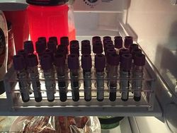 Gila Tapi Keren, Seniman Gunakan Darahnya Untuk Melukis