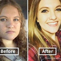 Dengan diet dan olahraga, wanita ini merasa kini lebih bahagia dan sehat setelah berat badannya turun drastis. Dia kini juga tidak lagi menderita diabetes dan tekanan darah tinggi. Foto: Dok. Bored Panda