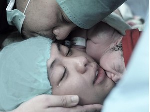 Ini tentang Simfisis Pubis Disfungsi Seperti yang Dialami Oki Setiana Dewi