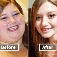 Wanita ini mengalami penurunan berat badan yang sangat banyak. Dalam waktu 18 bulan, bobotnya susut sebanyak 136 kg dan lihat betapa berbedanya wajahnya dulu dan sekarang. Foto: Dok. Bored Panda