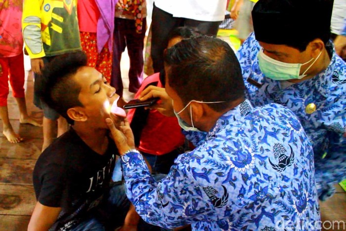 12 Kasus Difteri Ditemukan di Aceh Utara, Satu Orang Positif