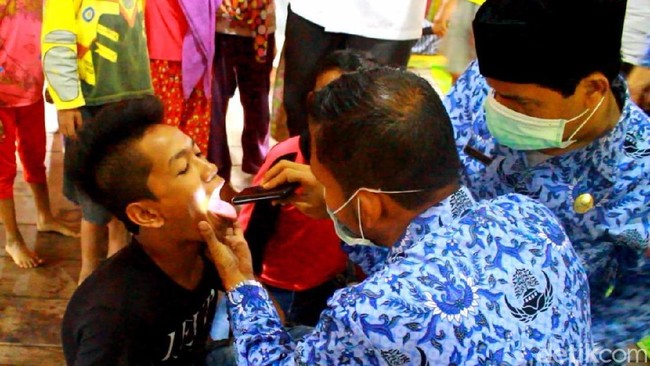 4 Gejala Penyakit Difteri dan Pencegahannya