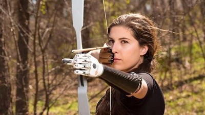 Angel Giuffria, Wanita Cantik dengan Lengan Prostetik yang Rajin Olahraga