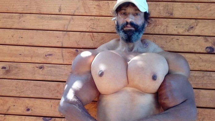 Pria yang suntikkan minyak ke tubuhnya agar terlihat besar.