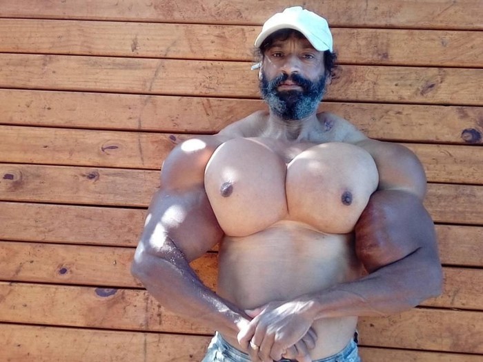 Lagi! Pria Ini Suntikan Minyak ke Tubuhnya Demi Punya Otot Besar