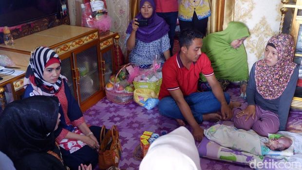 Menderita Hidrosefalus, Bayi Afifah Konsumsi Susu Melalui Selang