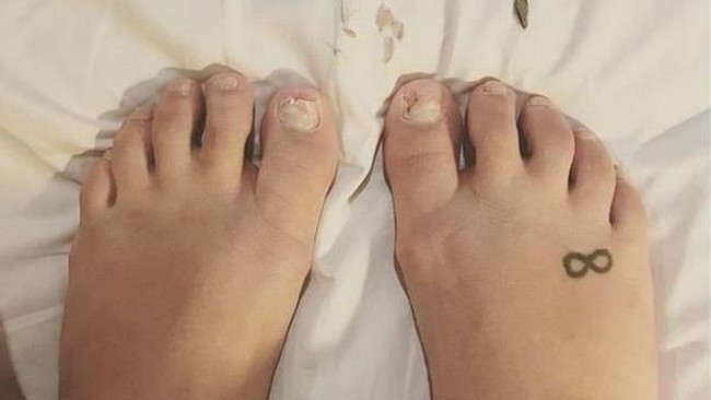 Warna Kuku Kaki Bisa Tandai Kesehatanmu