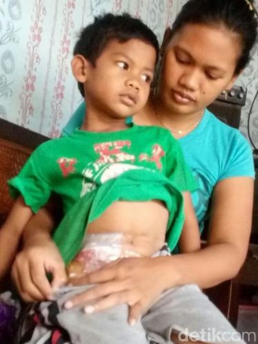 Febrio sejak usai 7 tahun BAB melalui perut/
