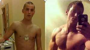 Foto: Transformasi Super, Dari Pasien Kanker Sampai Jadi Body Builder