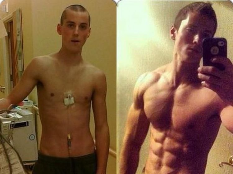 Foto: Transformasi Super, Dari Pasien Kanker Sampai Jadi Body Builder
