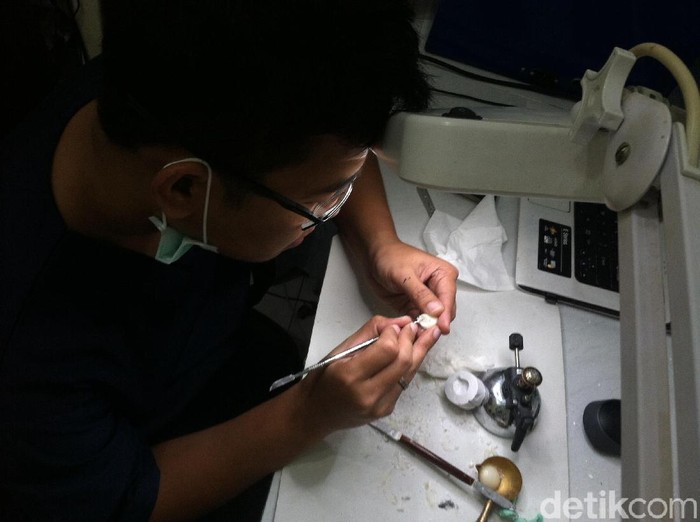 Seribu Mata Palsu untuk Pengidap Retinoblastoma