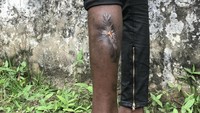 Seorang anak lelaki di Congo memperlihatkan bekas luka di kaki kirinya saat masih bergabung bersama milisi melawan pasukan keamanan. Ribuan keluarga diungsikan akibat konflik tersebut. Istimewa/UNICEF/Patrick Rose.
