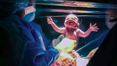 Oek, oek! Momen Saat si Kecil Lahir Lewat Operasi Caesar