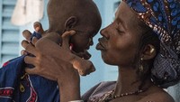 Seorang ibu bernama Anta Cisse terlihat menggendong putrinya Balco Diallo yang berusia 24 bulan dan mengidap gizi buruk akut dengan komplikasi di pusat referensi kesehatan CSREF di Mopti, Mali. Hingga kini daeraht tersebut masih terpengaruh oleh konflik bersenjata yang meletus pada 2012 lalu. Istimewa/UNICEF/Vlad Sokhin