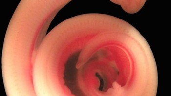 Bayi ular. (Foto: National Geographic)