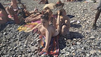 Badan wanita ini sungguh aneh jadinya. (Foto: Dailymail)