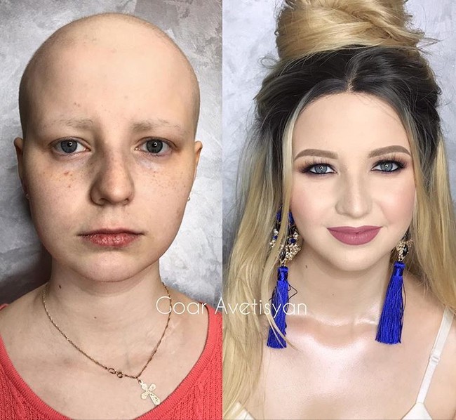 Julia tengah berjuang melawan kanker yang membuatnya kehilangan rambut. Goar Avetisyan membantunya kembali percaya diri dengan makeup. Foto: Instagram Goar Avetisyan