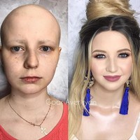 Julia tengah berjuang melawan kanker yang membuatnya kehilangan rambut. Goar Avetisyan membantunya kembali percaya diri dengan makeup. Foto: Instagram Goar Avetisyan
