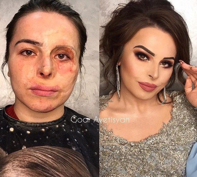 Jamilya mengalami luka bakar saat usianya 2,5 tahun. Lihat bagaimana dia berubah menjadi wanita berbeda hanya dengan makeup. Foto: Instagram Goar Avetisyan