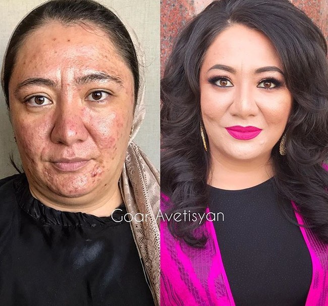 Melalui makeup, Goar Avetisyan membuktikan semua wanita bisa mirip bintang Hollywood, termasuk wanita yang wajahnya dipenuhi jerawat dan flek ini. Foto: Instagram Goar Avetisyan