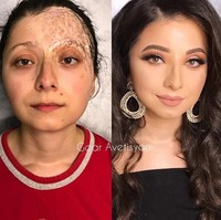 Lilya sudah melalui dua kali operasi cangkok kulit. Bekas luka di wajahnya menjadi tidak terlihat berkat makeup. Foto: Instagram Goar Avetisyan