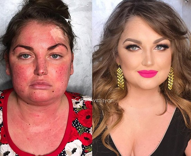 Wanita di foto ini bernama Kate. Dia memiliki kulit yang sangat sensitif sehingga gampang kemerahan. Namun Goar berhasil membuat wajahnya jadi flawless lewat makeup. Foto: Instagram Goar Avetisyan