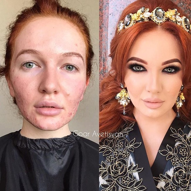 Goar Avetisyan berhasil mengembalikan kepercayaan diri wanita yang wajahnya berjerawat ini dengan makeup flawless dan riasan bold pada mata. Foto: Instagram Goar Avetisyan