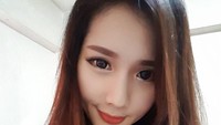 Padahal semasa hidup diketahui Stella tidak memiliki riwayat medis dengan penyakit pada otak.