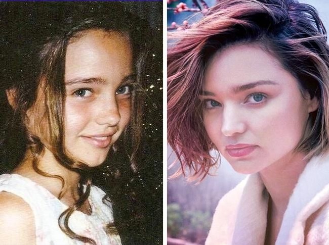 Wajah Miranda Kerr tampak tidak berubah sejak kecil hingga dewasa. Dia memiliki senyum menawan dan mata yang ekspresif. Dua hal itu juga yang membuatnya menjadi salah satu model paling laris. (Foto: Instagram)