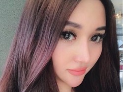 Beda Jauh, Intip 7 Transformasi Lucinta Luna Dulu Vs Usai Oplas Ganti Kepala