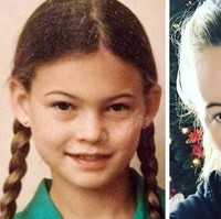 Behati Prinsloo termasuk model yang tak sungkan berbagi wajah ‘jeleknya’ di media sosial. Behati pun tak malu dengan kuping caplang yang dimilikinya sejak kecil. Baginya tidak perlu operasi plastik untuk mengubah apapun penampilannya. (Foto: Instagram)