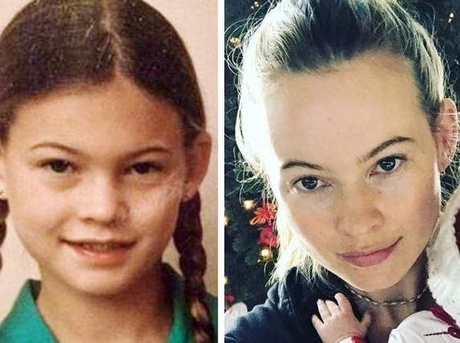 Behati Prinsloo termasuk model yang tak sungkan berbagi wajah ‘jeleknya’ di media sosial. Behati pun tak malu dengan kuping caplang yang dimilikinya sejak kecil. Baginya tidak perlu operasi plastik untuk mengubah apapun penampilannya. (Foto: Instagram)