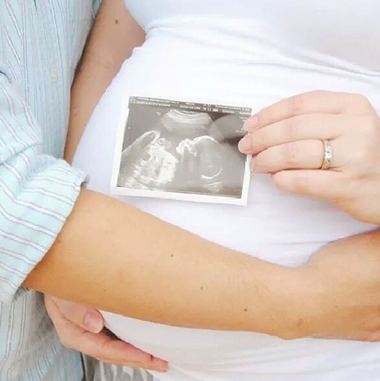 Cek di Sini, Bun, Aneka Inspirasi Maternity Photoshoot