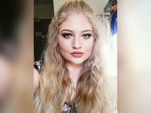 Foto Pengidap Body Dysmorphic Disorder yang Selalu Merasa Jelek