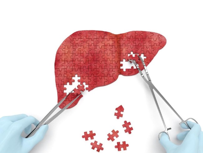 5 Tanda Adanya Masalah pada Organ Hati Manusia