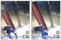 Kaki Wanita Ini Putus Karena Ponsel, Kok Bisa?